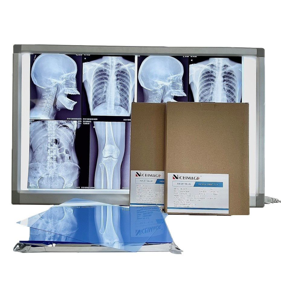 THỦ TỤC NHẬP KHẨU PHIM X-QUANG DÙNG TRONG Y TẾ